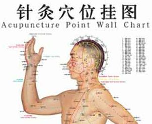Acupuncture.jpg