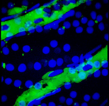 Image Description: This picture shows two blood vessels overlying the inner layers of the retina in adult zebrafish. The endothelial cells forming the walls of the vessels are green (EGFP) and the nuclei of all cells are blue (DAPI staining).
