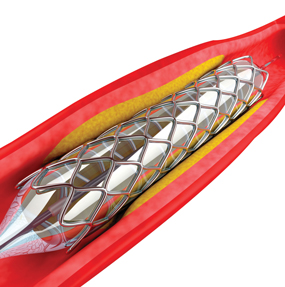 Medical Device Design