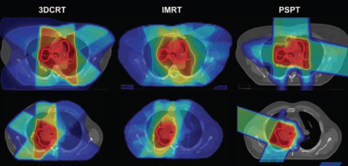 Radiation Oncology Physics