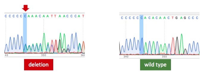 Genetics of Rare Diseases