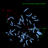 a 'translocation' that is a switch of DNA between 2 different chromosomes