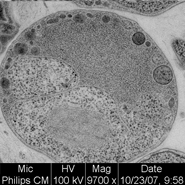 Sewage water bacteria fills ‘missing link’ in early evolution of life on earth