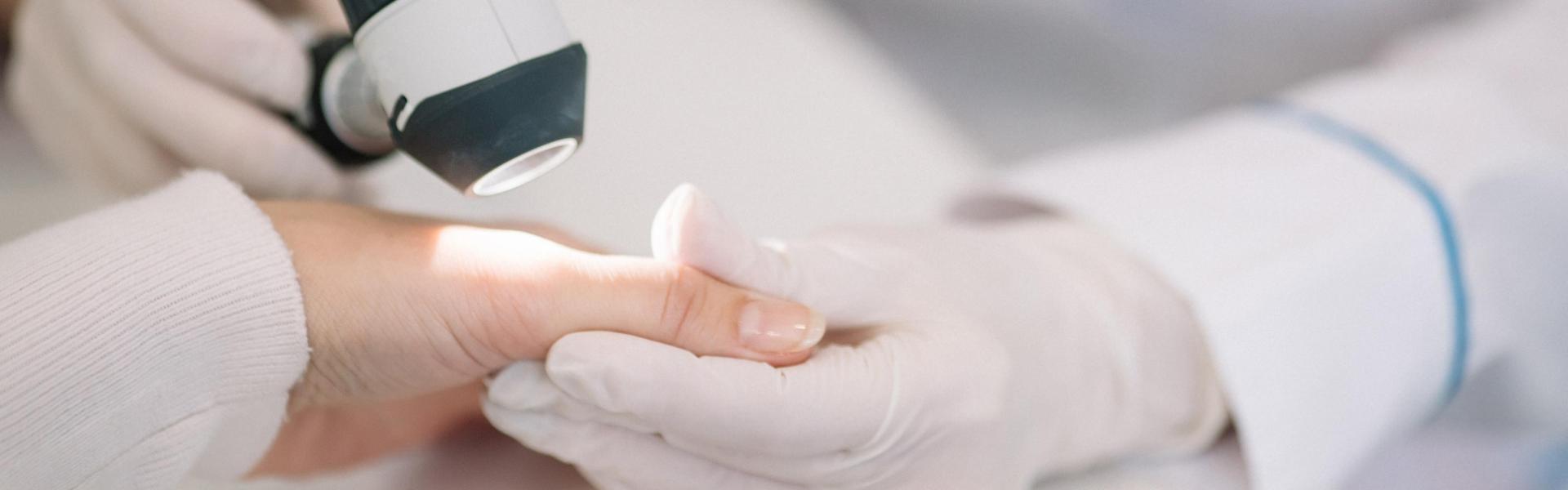 A dermatologist examining a patients hand