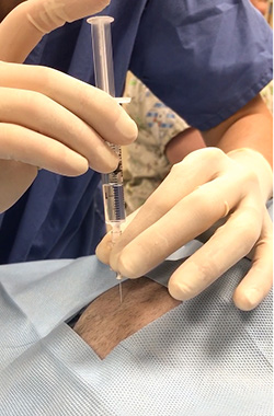 Image of gloved hands injecting syringe of liquid into an animal that has been shaved and prepped for surgery